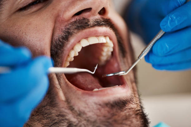 Best Broken Tooth Emergency  in Plymouth, PA